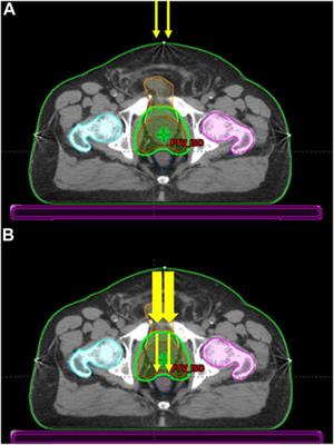 A stochastic reaction–diffusion modeling investigation of FLASH ultra-high dose rate response in different tissues